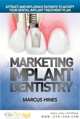 Marketing Implant Dentistry : Attract and Influence Patients to Accept Your Dental Implant Treatment Plan