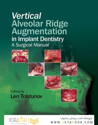 Vertical Alveolar Ridge Augmentation in Implant Dentistry : A Surgical Manual