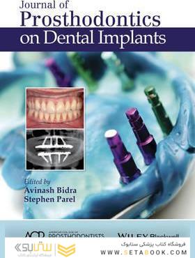 Journal of Prosthodontics on Dental Implants