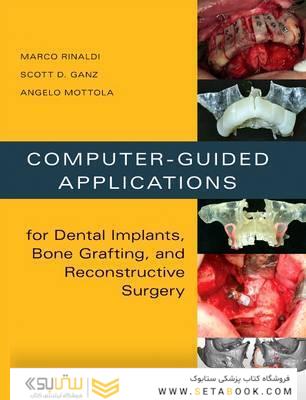 Computer-Guided Applications for Dental Implants, Bone Grafting, and Reconstructive Surgery (adapted translation)