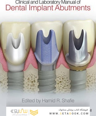 Clinical and Laboratory Manual of Dental Implant Abutments