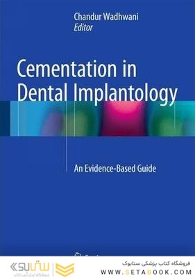Cementation in Dental Implantology : An Evidence-Based Guide2015