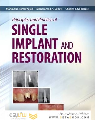 Principles and Practice of Single Implant and Restoration