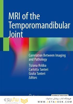 MRI of the Temporomandibular Joint : Correlation Between Imaging and Pathology