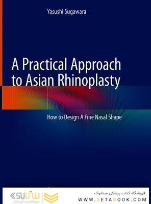 A Practical Approach to Asian Rhinoplasty
