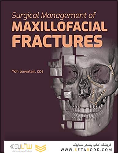Surgical Management of Maxillofacial Fractures