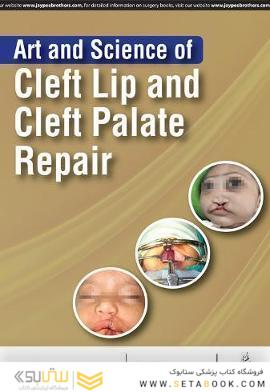 Art and Science of Cleft Lip and Cleft Palate Repair