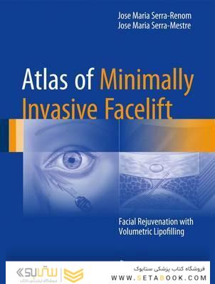Atlas of Minimally Invasive Facelift