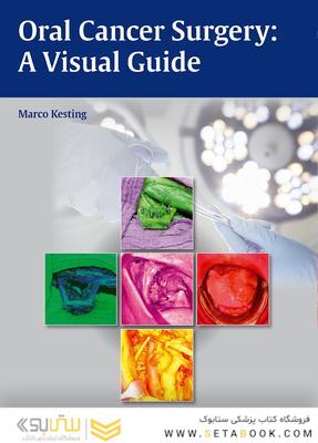 Oral Cancer Surgery : A Visual Guide