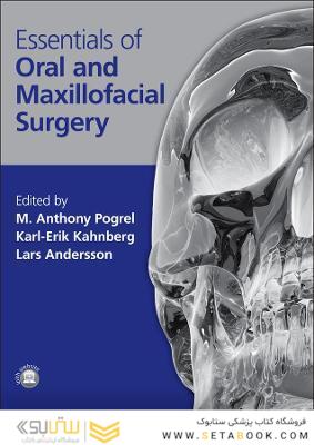 Essentials of Oral and Maxillofacial Surgery