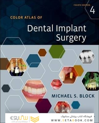 Color Atlas of Dental Implant Surgery 4th Edicion 2015