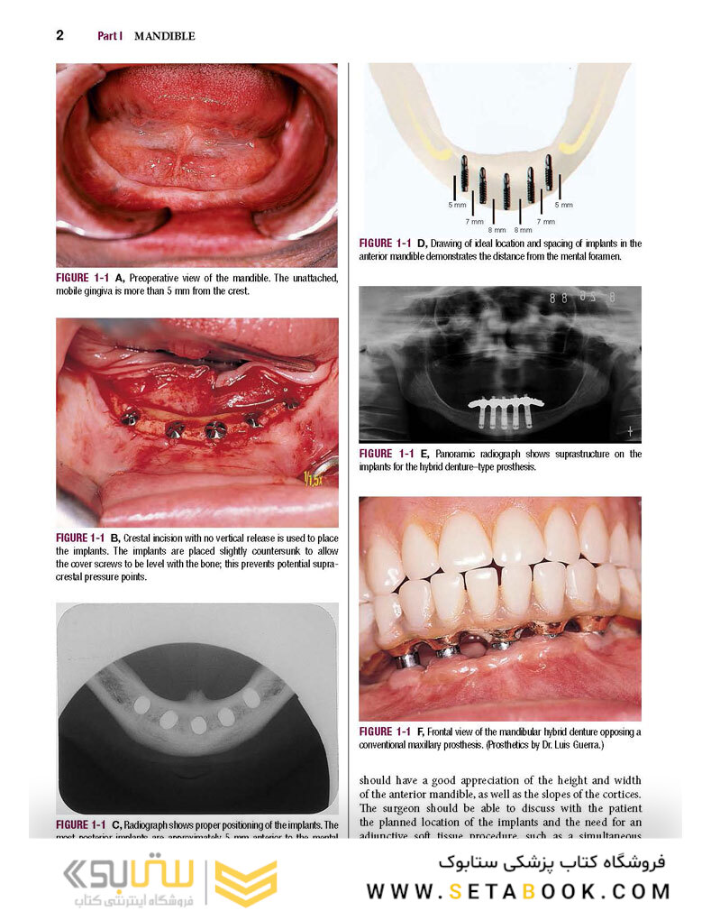 Color Atlas of Dental Implant Surgery 4th Edicion 2015