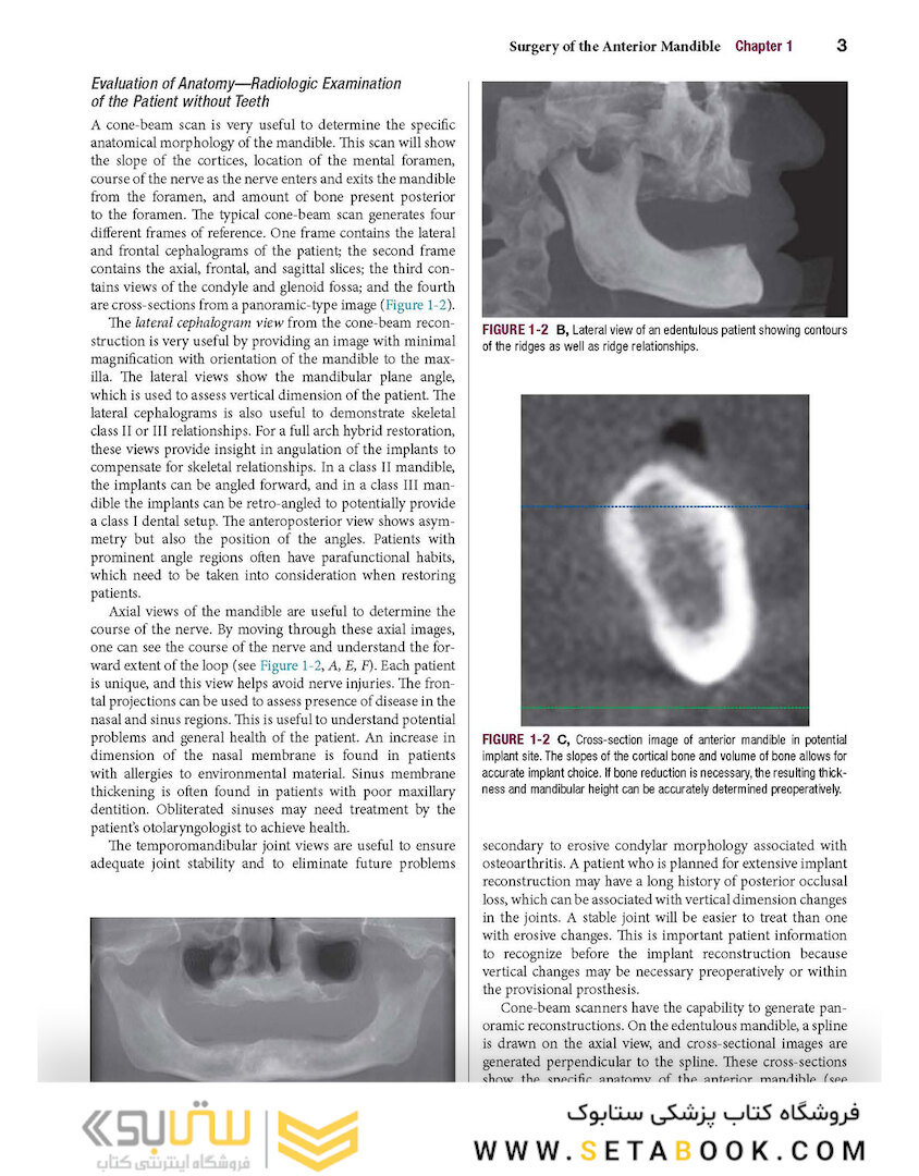 Color Atlas of Dental Implant Surgery 4th Edicion 2015