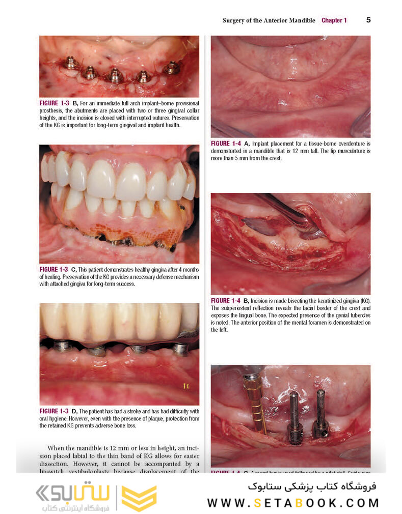 Color Atlas of Dental Implant Surgery 4th Edicion 2015
