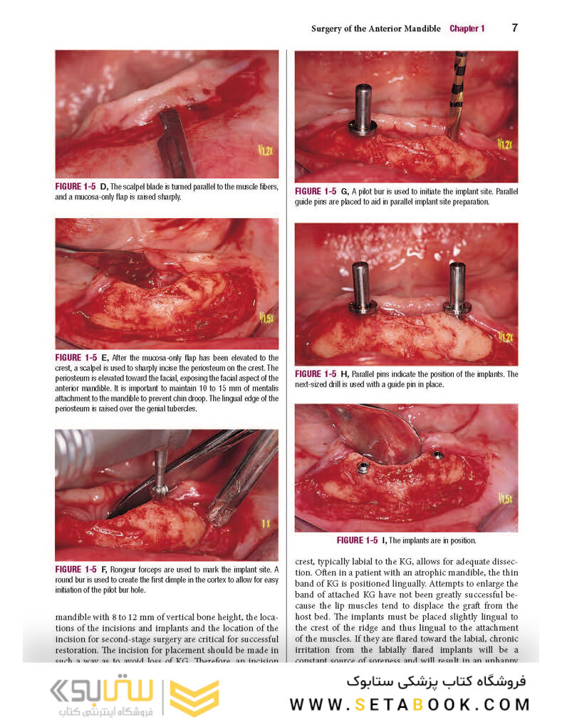 Color Atlas of Dental Implant Surgery 4th Edicion 2015