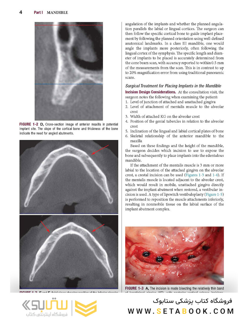 Color Atlas of Dental Implant Surgery 4th Edicion 2015