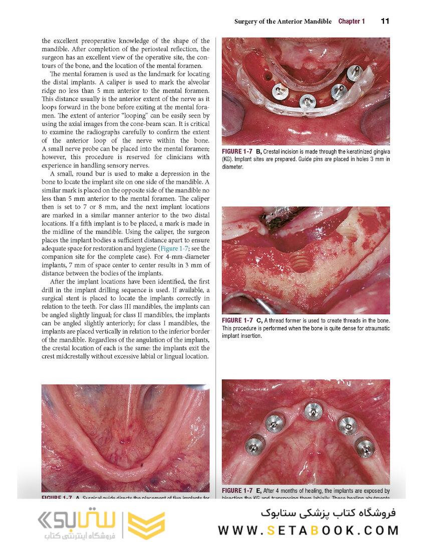 Color Atlas of Dental Implant Surgery 4th Edicion 2015