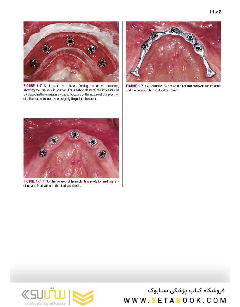 Color Atlas of Dental Implant Surgery 4th Edicion 2015