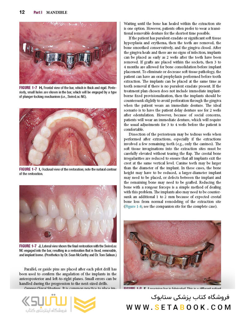 Color Atlas of Dental Implant Surgery 4th Edicion 2015