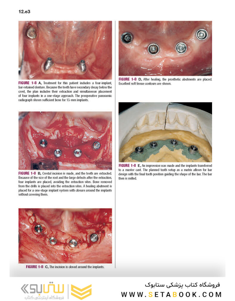 Color Atlas of Dental Implant Surgery 4th Edicion 2015