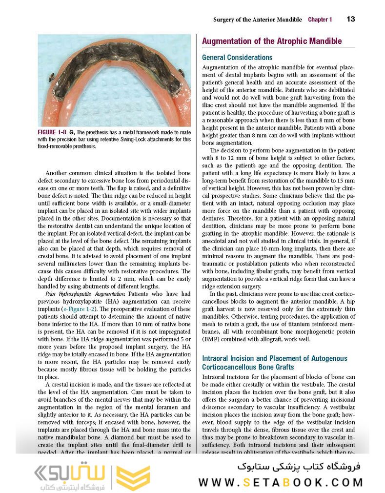 Color Atlas of Dental Implant Surgery 4th Edicion 2015