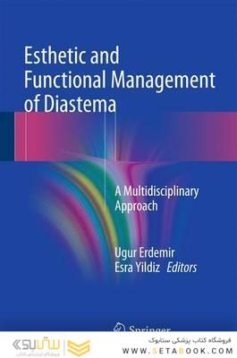 Esthetic and Functional Management of Diastema