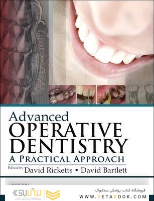 Advanced Operative Dentistry : A Practical Approach