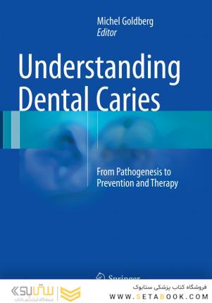Understanding Dental Caries