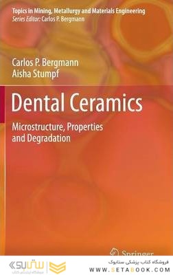 Dental Ceramics