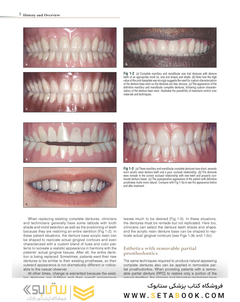 Introduction to Metal-Ceramic Technology