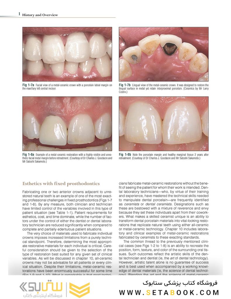 Introduction to Metal-Ceramic Technology