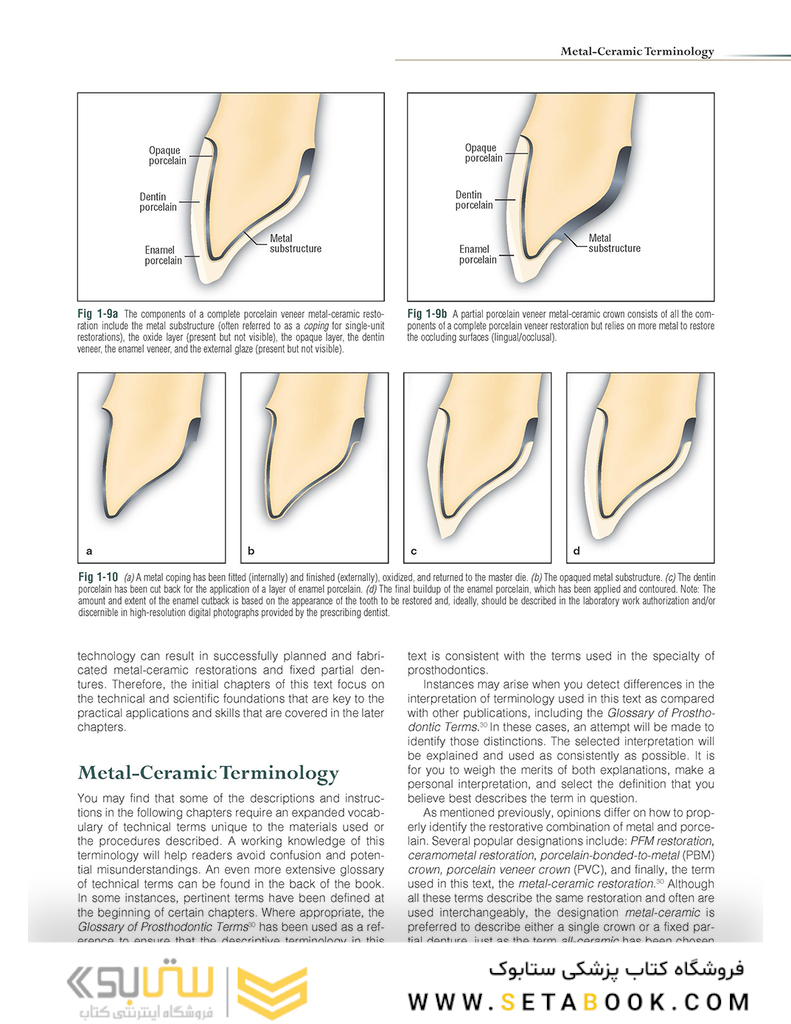 Introduction to Metal-Ceramic Technology