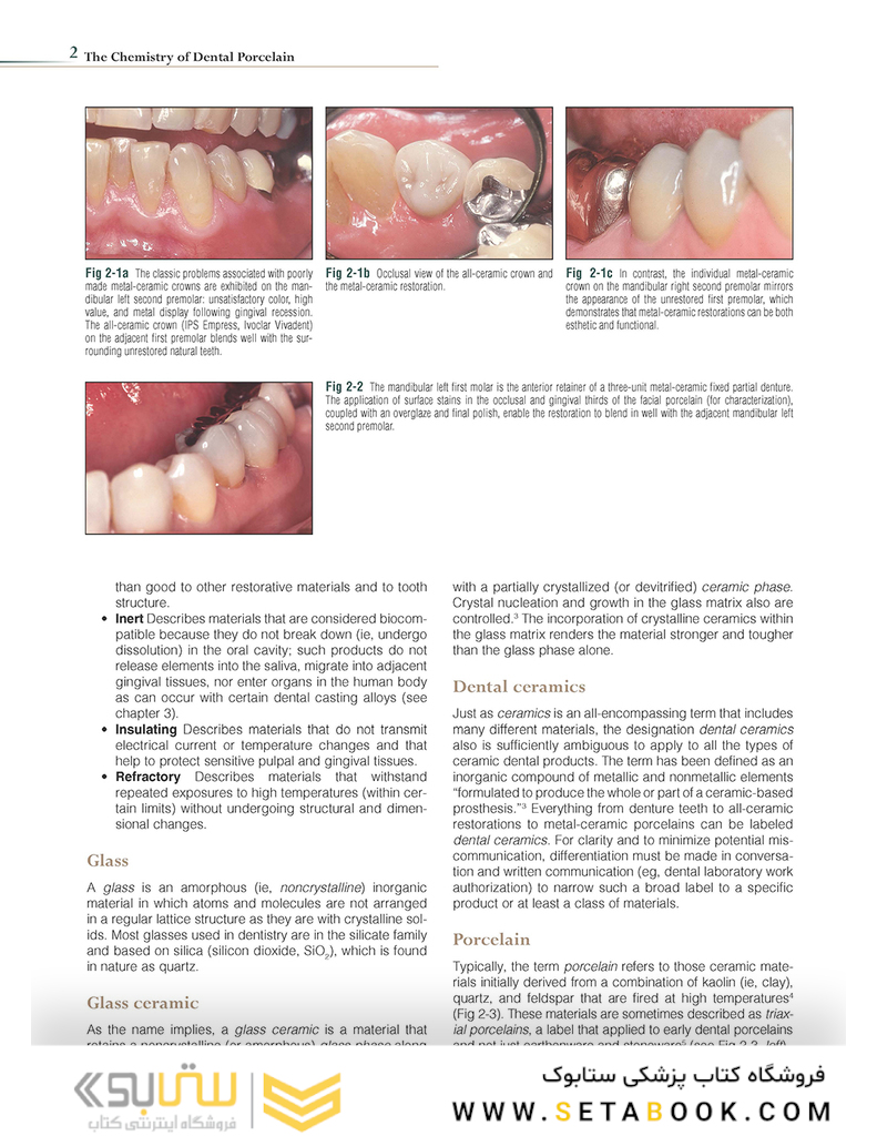 Introduction to Metal-Ceramic Technology