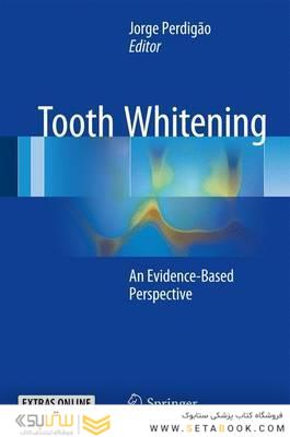 Tooth Whitening