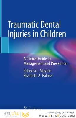 Traumatic Dental Injuries in Children