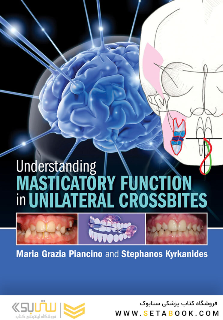 Understanding Masticatory Function in Unilateral Crossbites