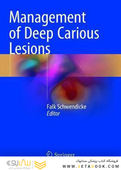 Management of Deep Carious Lesions 2018