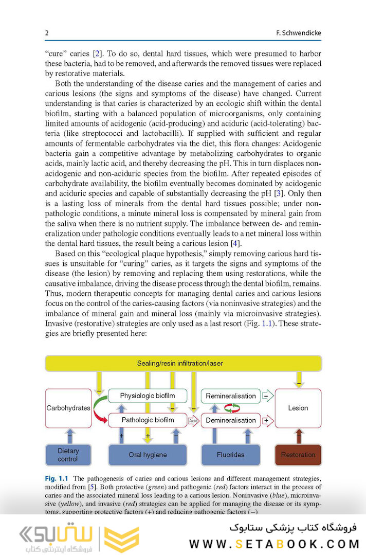 Management of Deep Carious Lesions 2018