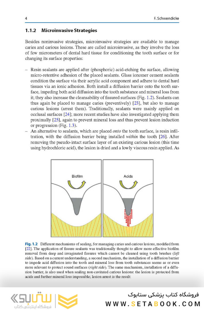 Management of Deep Carious Lesions 2018
