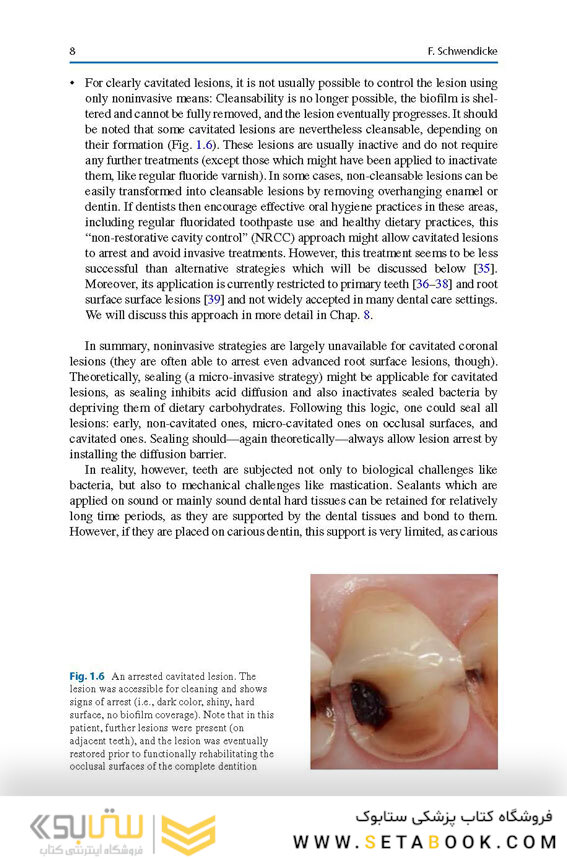 Management of Deep Carious Lesions 2018