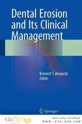 Dental Erosion and Its Clinical Management