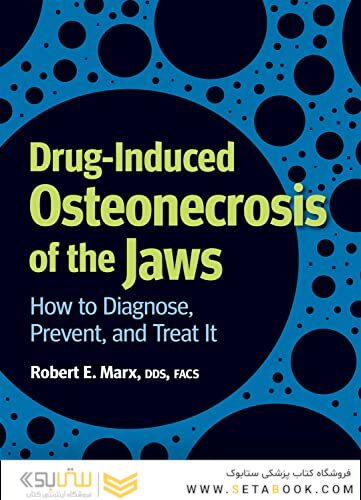 Drug-Induced Osteonecrosis of the Jaws