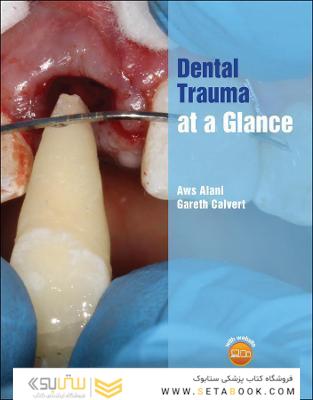 Dental Trauma at a Glance 2021