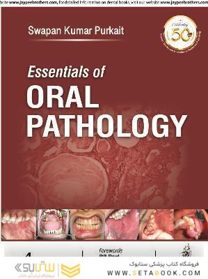 Essentials of Oral Pathology 2019