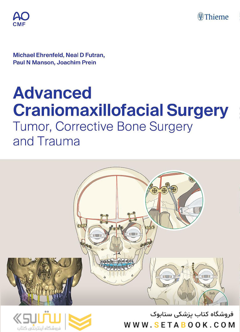 Advanced Craniomaxillofacial Surgery : Tumor, Corrective Bone Surgery, and Trauma 2020