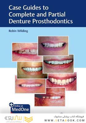 Case Guides to Complete and Partial Denture Prosthodontics 2020