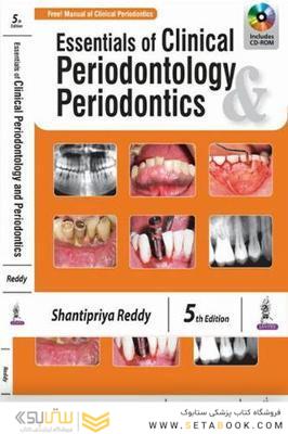 Essentials of Clinical Periodontology - Periodontics