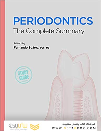 Periodontics: The Complete Summary 1st Edition