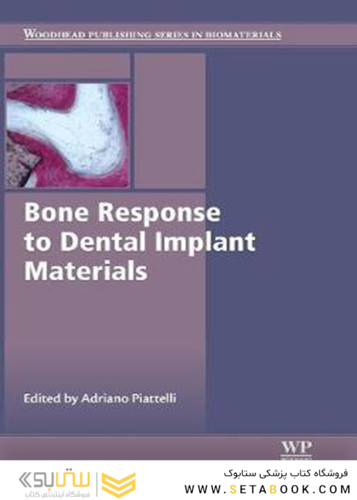 Bone Response to Dental Implant Materials 2016