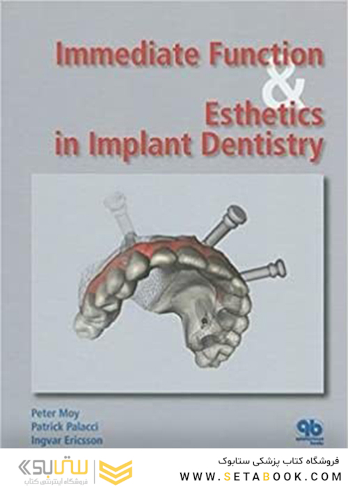 Immediate Function and Esthetic in Implant Dentistry